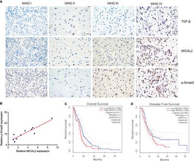 MICAL2 Promotes Proliferation and Migration of Glioblastoma Cells Through TGF-β/p-Smad2/EMT-Like Signaling Pathway